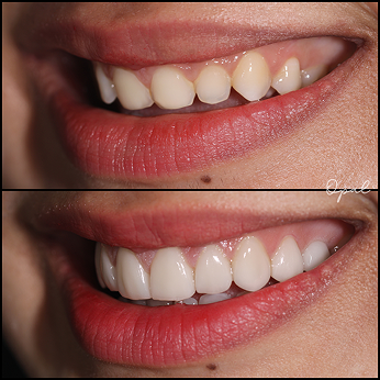 Before Treatment 2