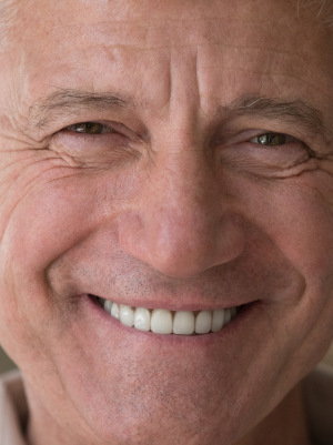 Invisible Aligners Treatment