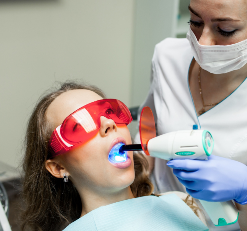Tooth Bonding