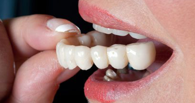 Smile Result