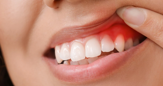 Smile Result