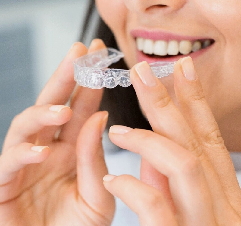 Tooth Bonding