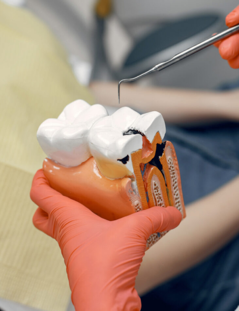 Smile Design Treatment