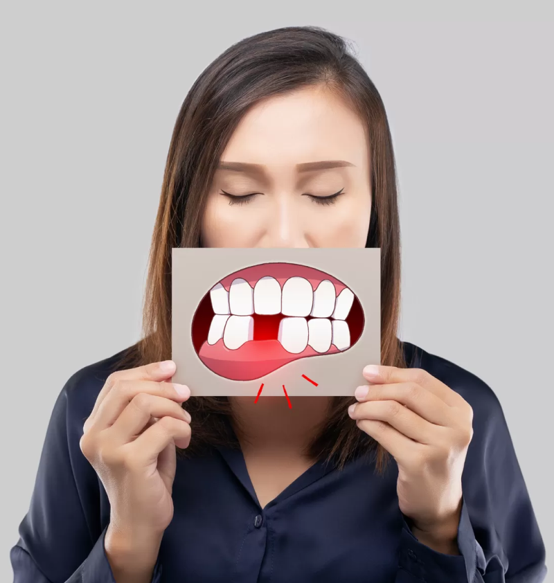 Invisalign Experience