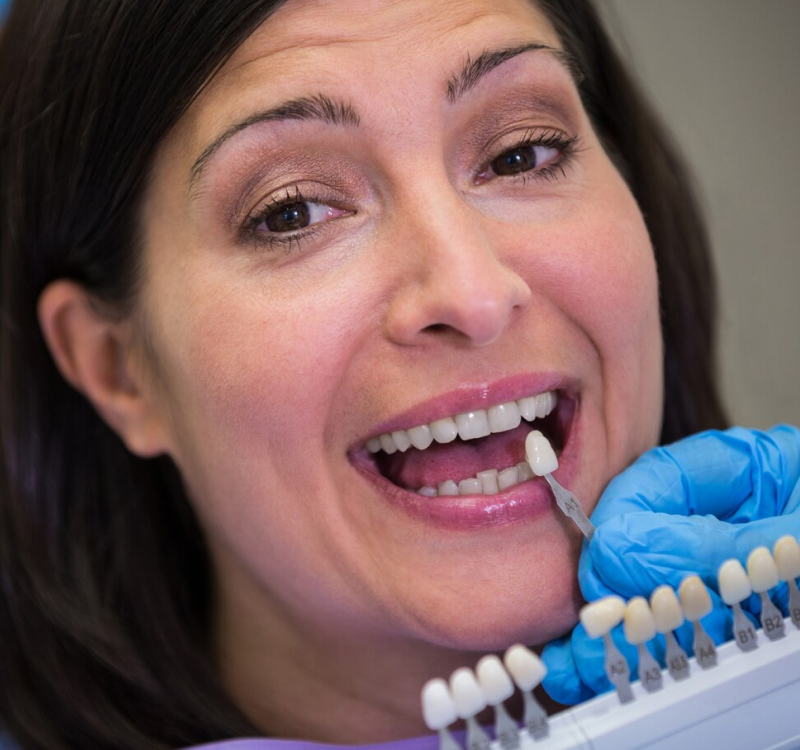 Tooth Bonding