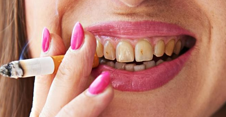 Smoking And Oral Health