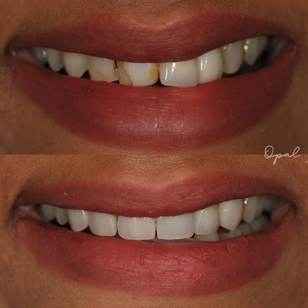 Client Smile
