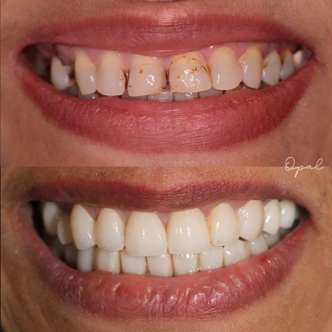 Client Smile