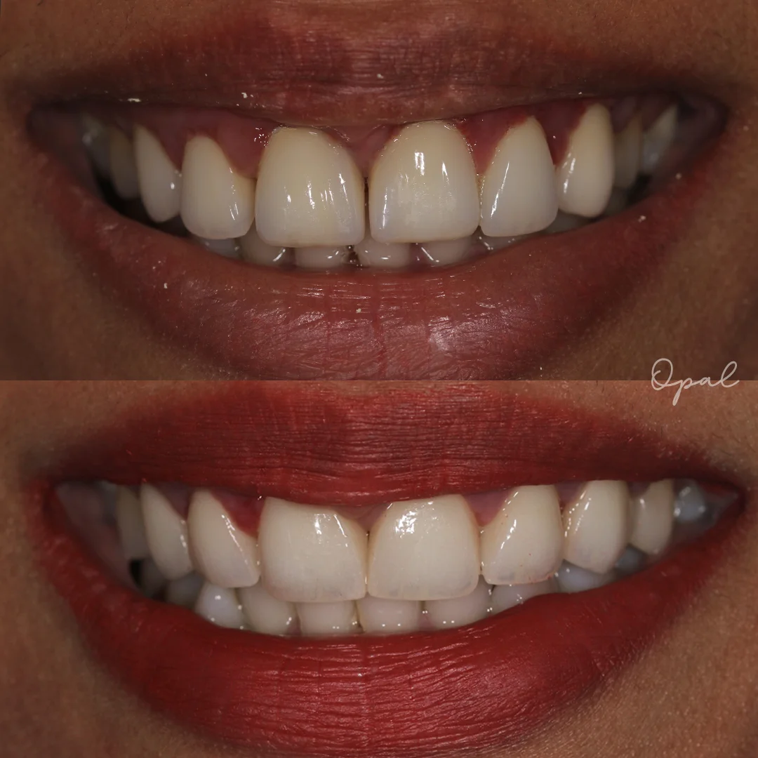Client Smile