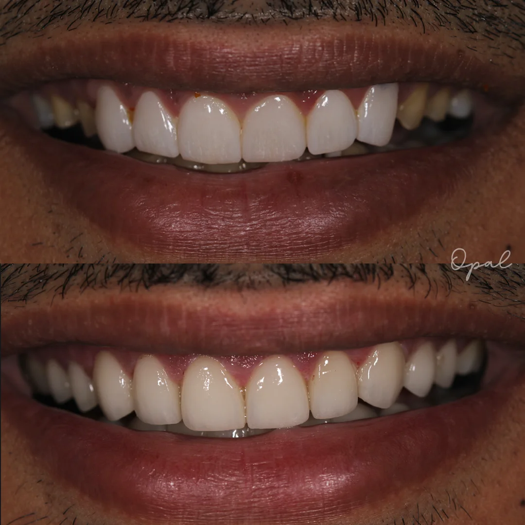 Client Smile