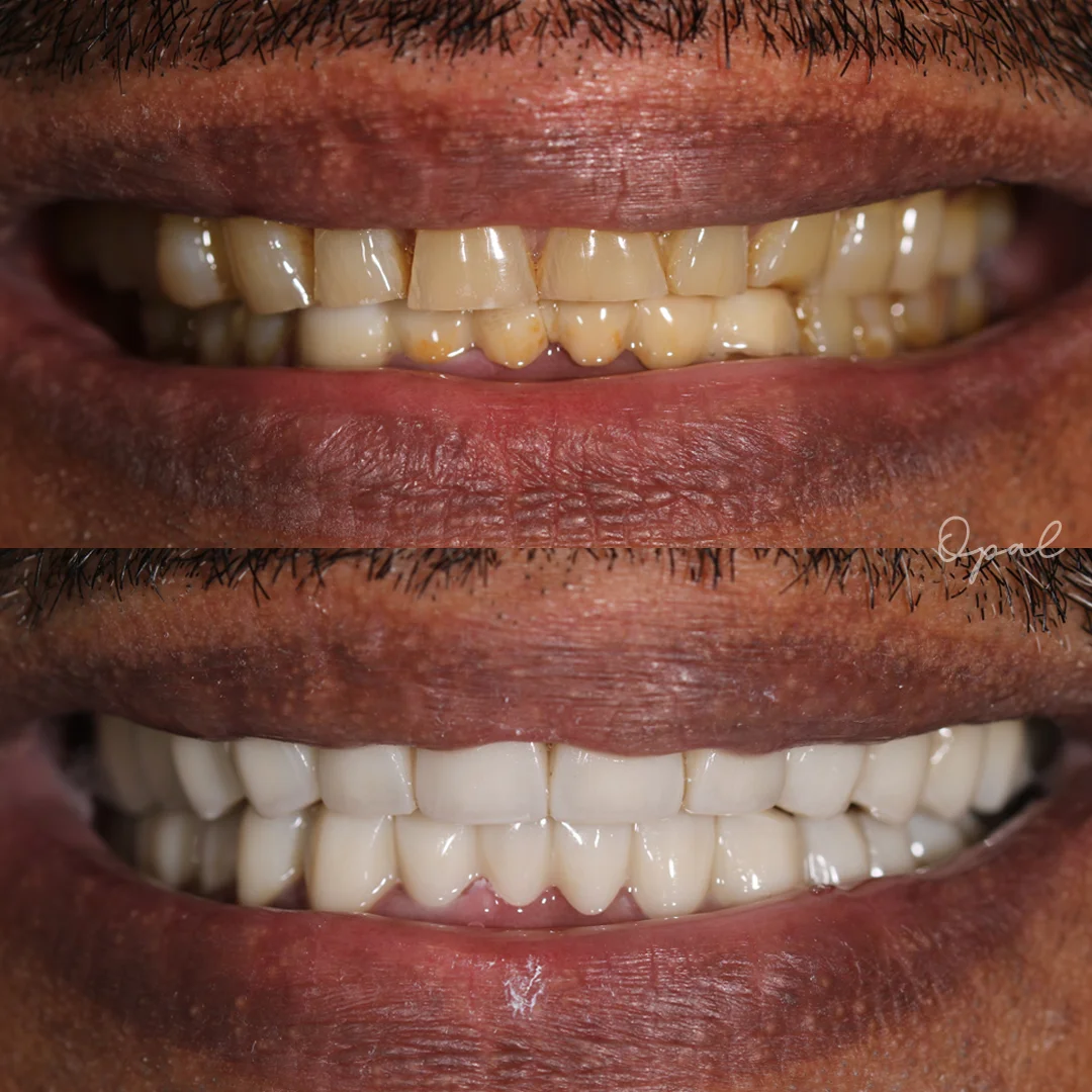 Client Smile