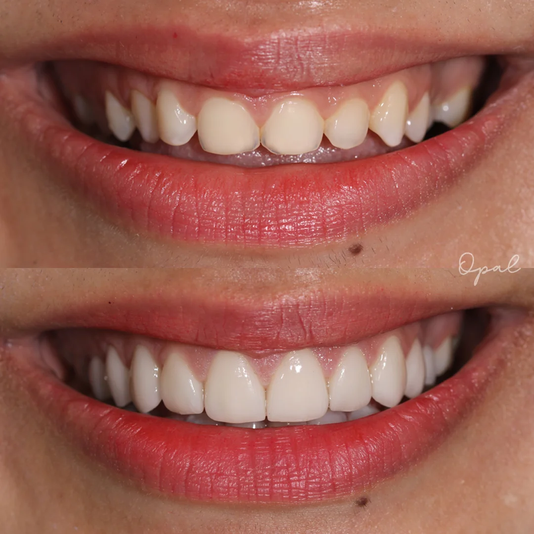 Client Smile