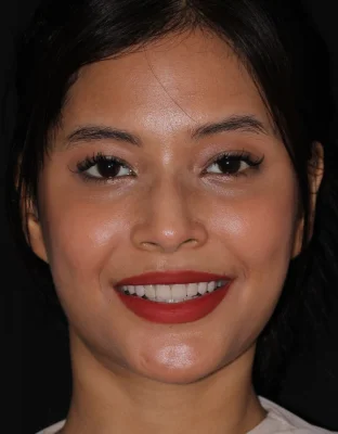 Happy Patient Smile 1