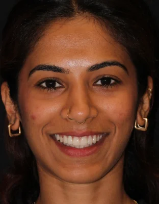 Happy Patient Smile 2