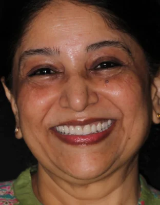 Happy Patient Smile 3