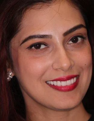 Happy Patient Smile 5