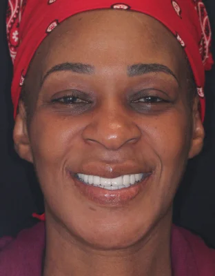 Happy Patient Smile 1