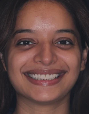 Happy Patient Smile 2