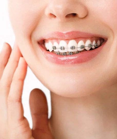 Smile Design Treatment