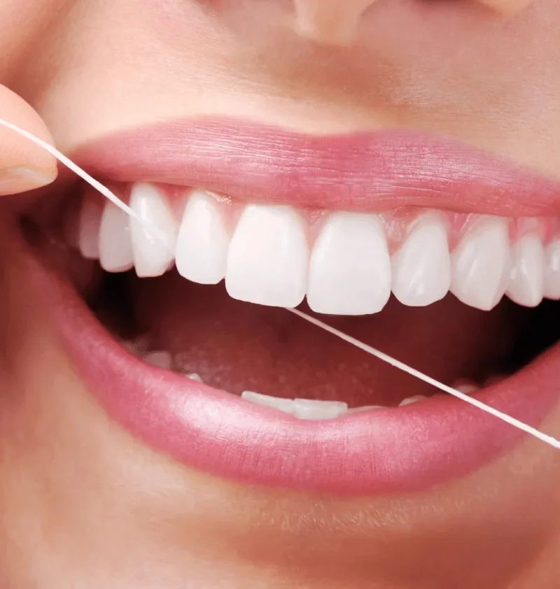 Invisalign Experience