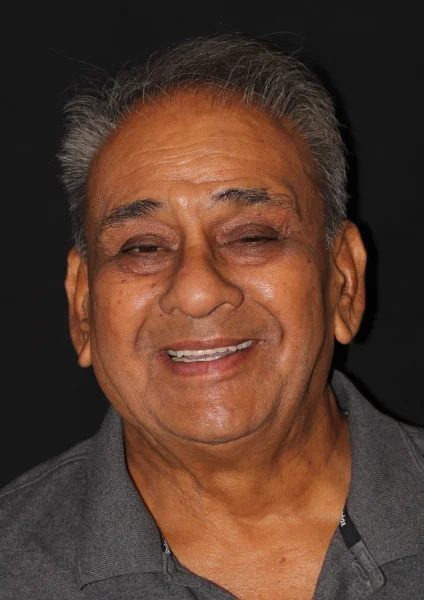 Dental Implants Treatment